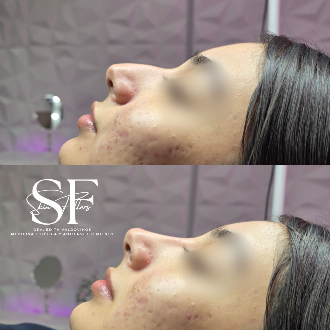 Edith Valdovinos Covarrubias-3