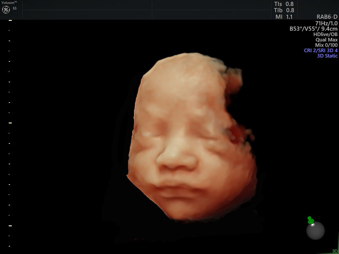 Oscar Alejandro Sánchez Gámez-6