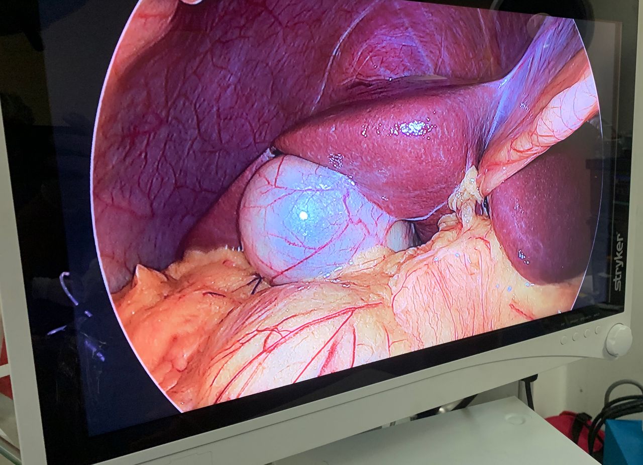 Diego Edwuin Rosales Carmona-15
