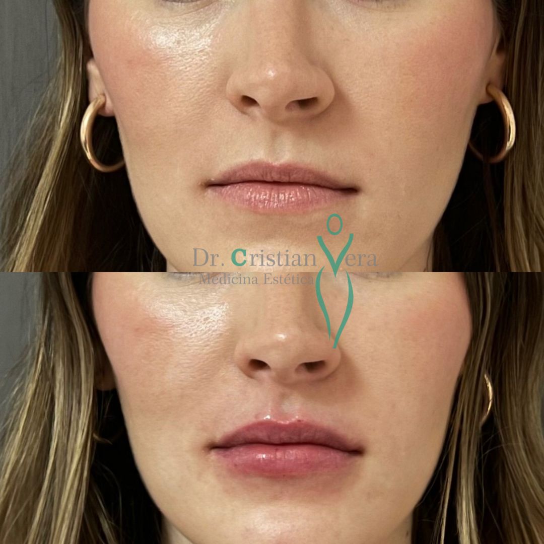 Cristian Eduardo Vera Nuño-9