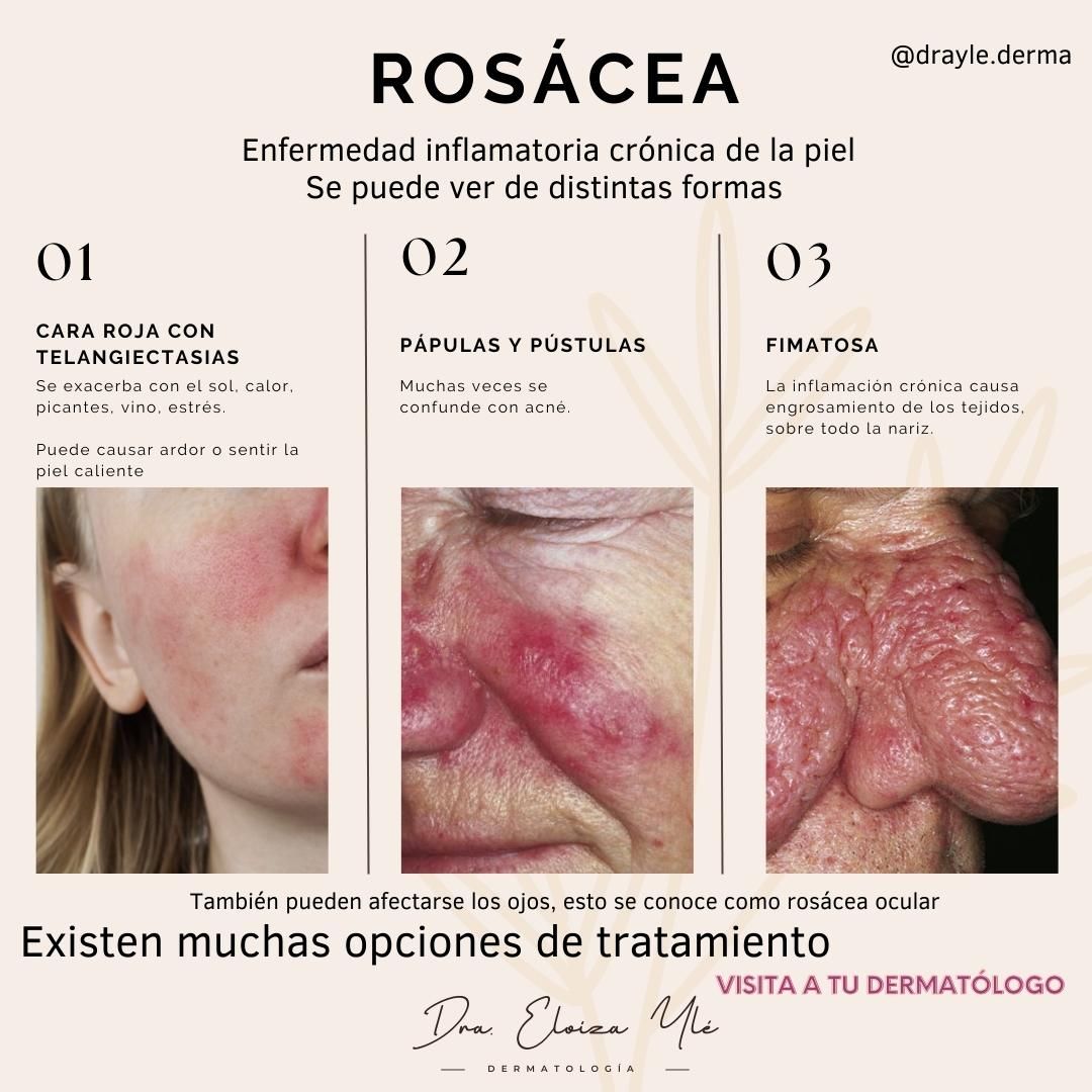 Eloiza Lizeth Ylé Arámburo-2