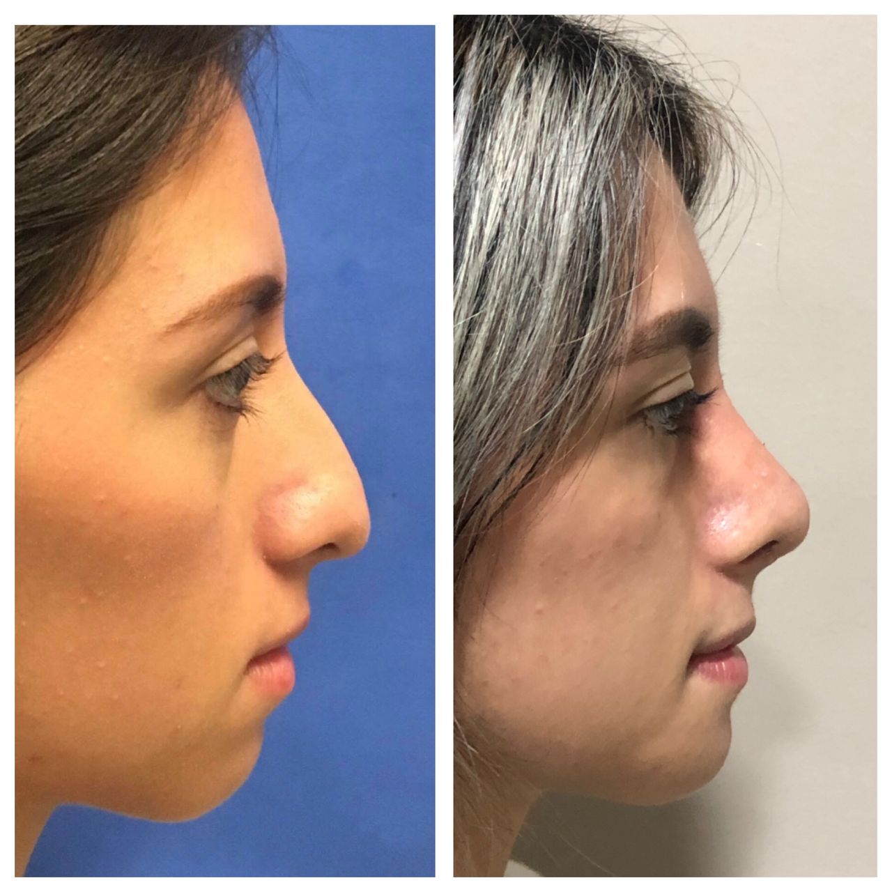 Alejandro Jimenez Garcia-16