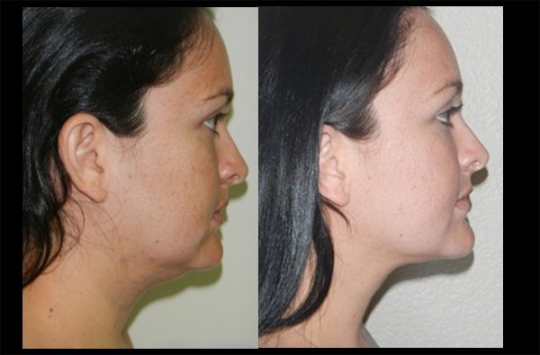 Edgar Ernesto Torres Mejía-11