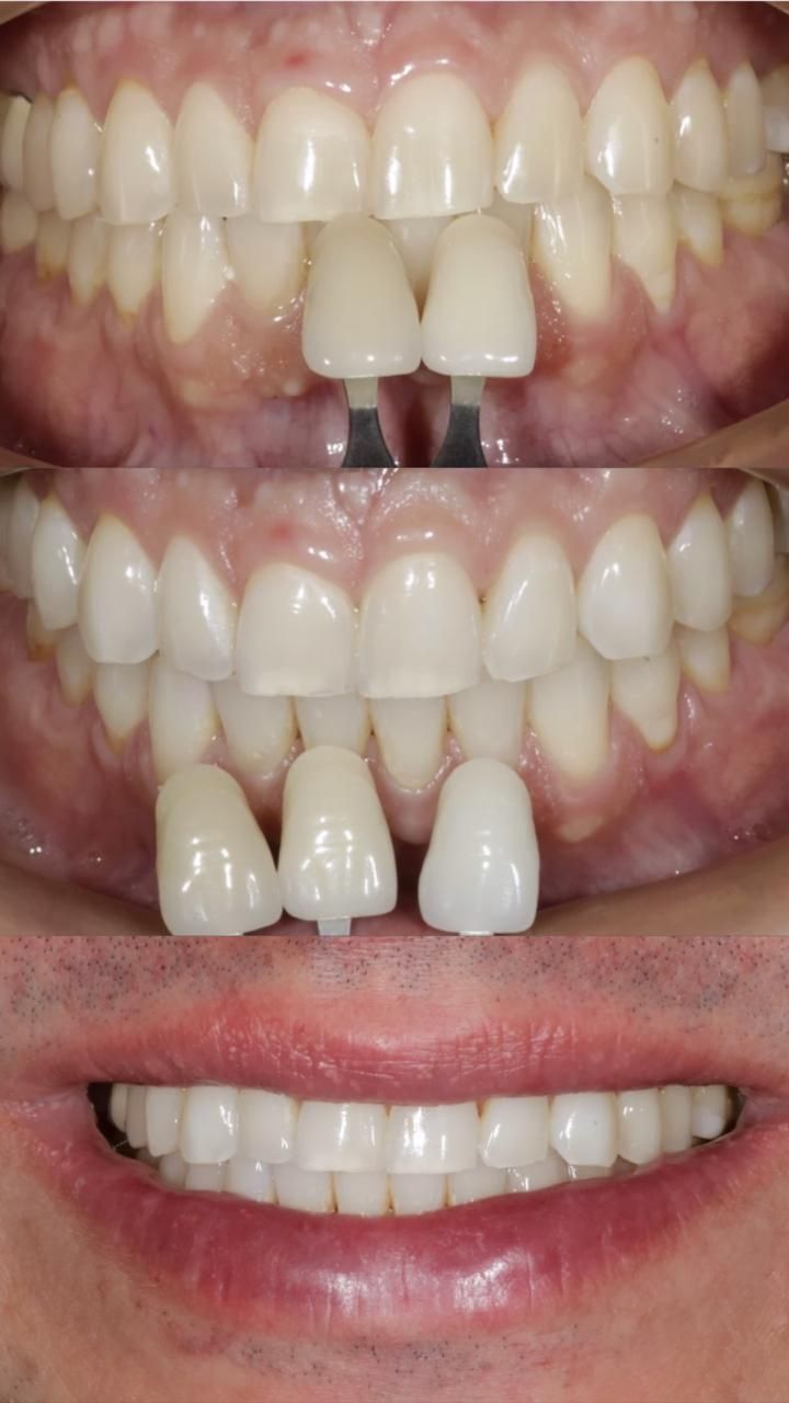 Israel Villarroel Cordoba-6