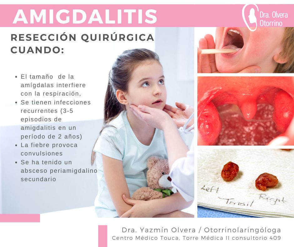 Ma. Yazmín Olvera Suárez-31