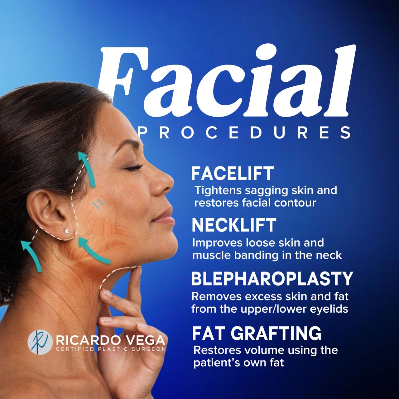 Ricardo Vega Montiel-2