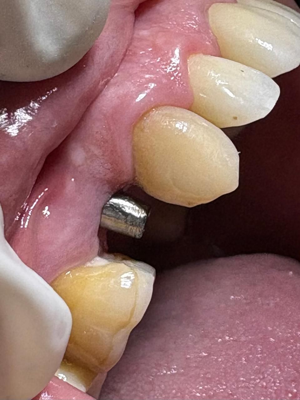 Arturo Romero Grande-34