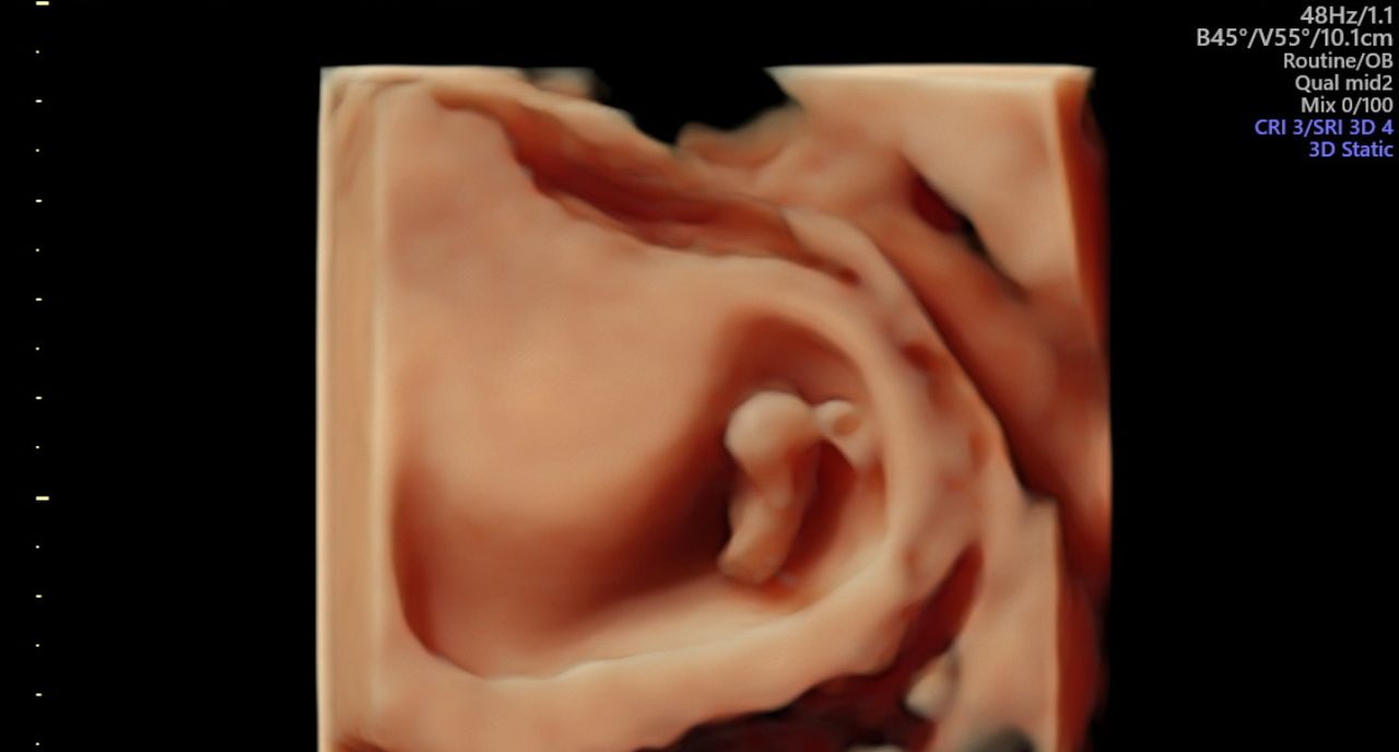 Angélica Mireles Garcia-1