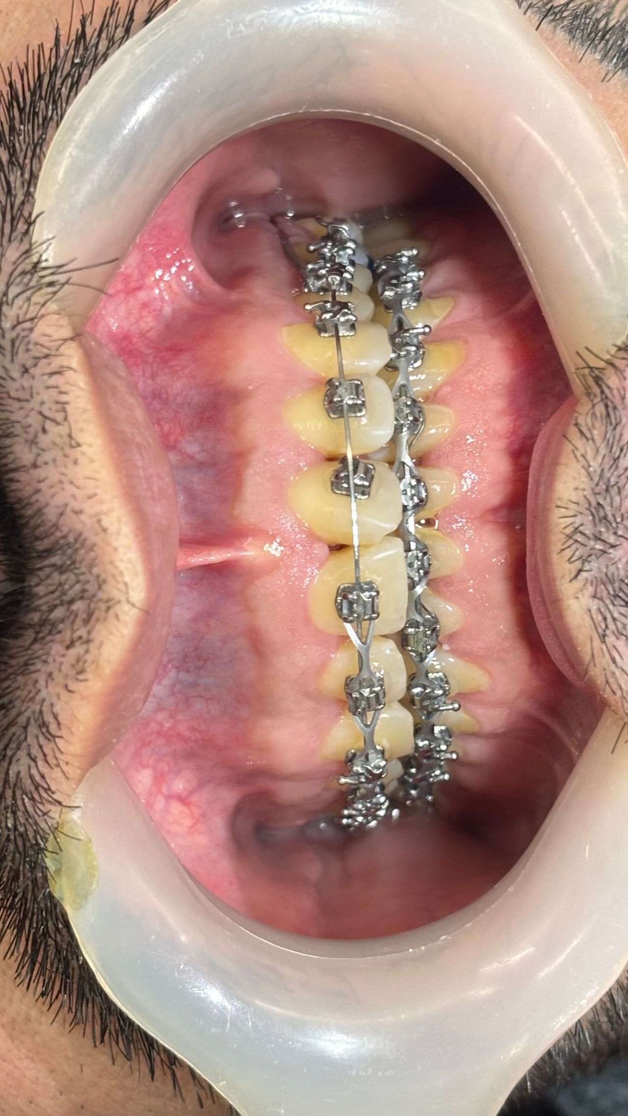 Priscila Berenice Gutiérrez Martínez-10