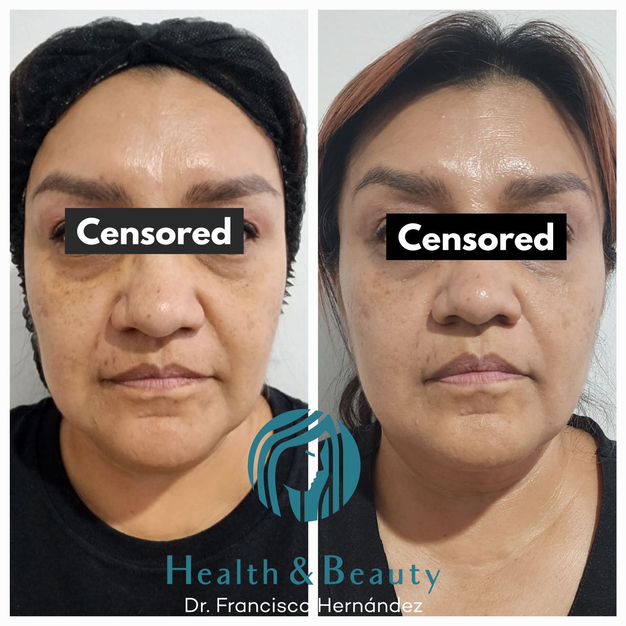 Francisco Hernández Gómez Crespo-33