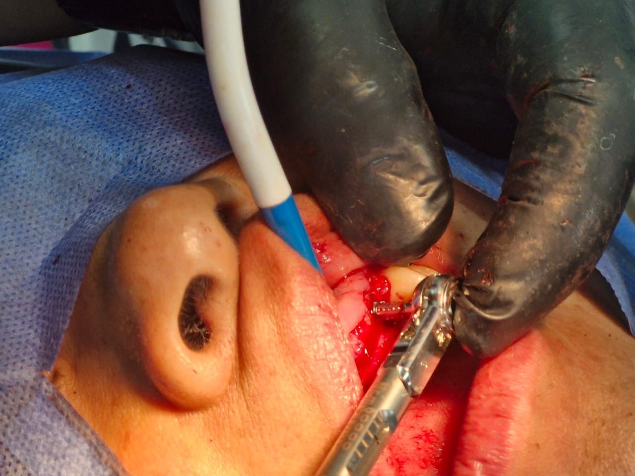 Jair Contreras García-50