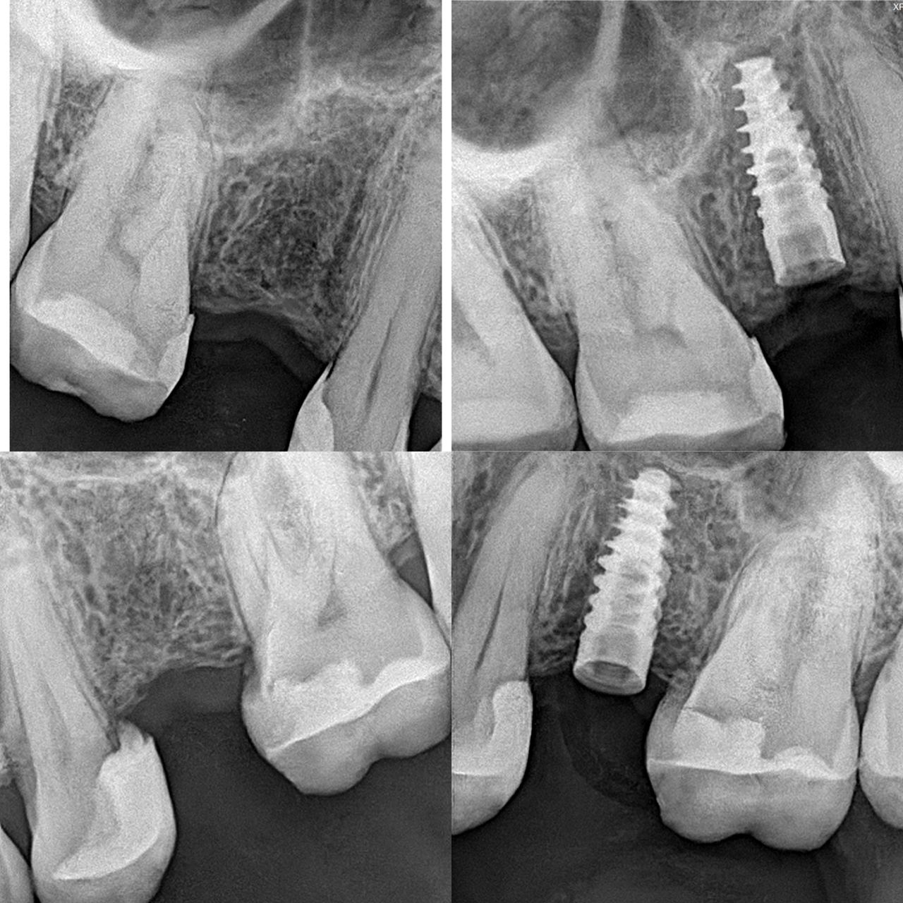 Emilio Amezaga Martínez-8