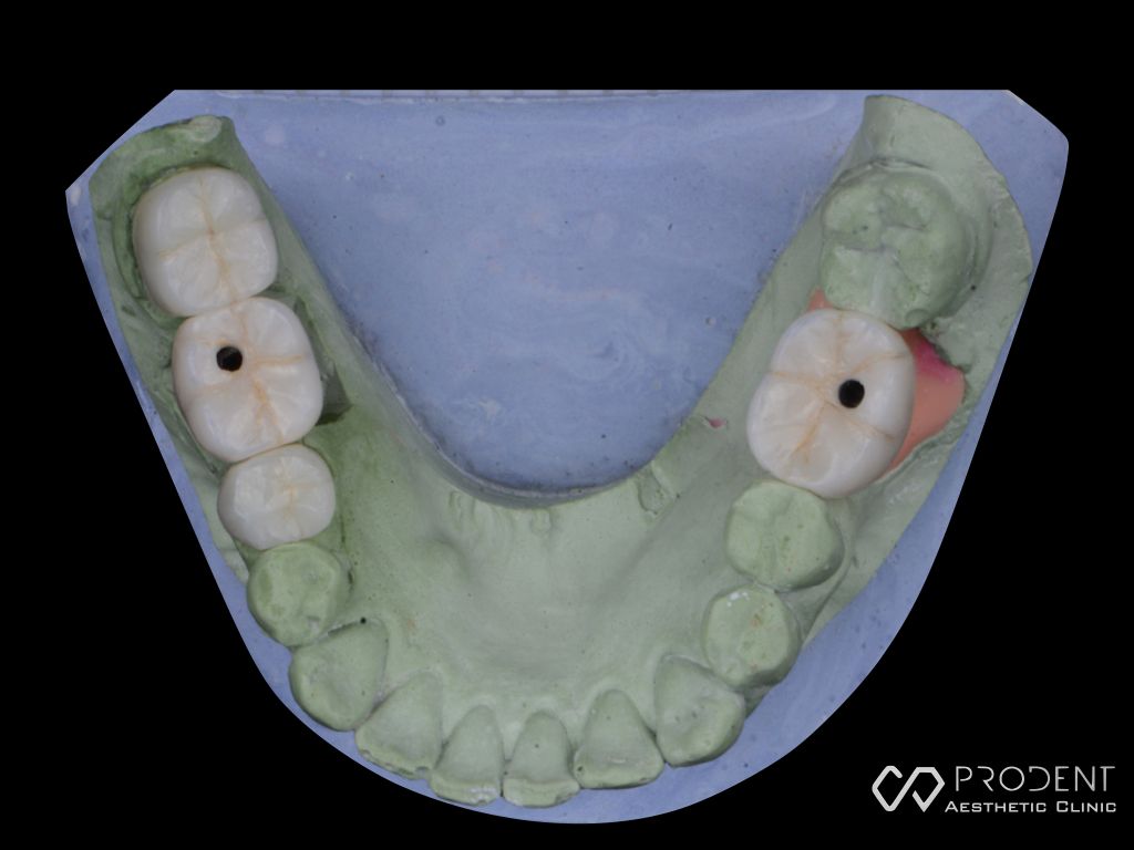 Ramiro Ivan Pérez Murillo-48