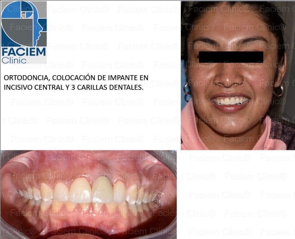 Arlen Colín Ordaz-14