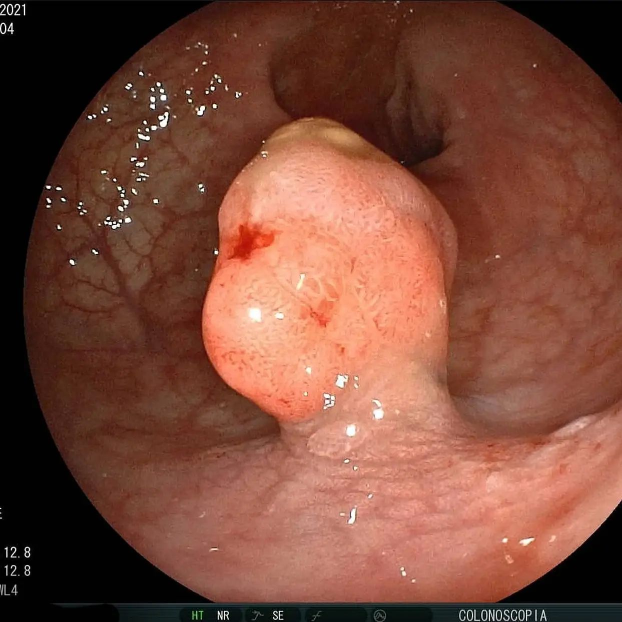 Edgar Alan De León Rojas-12