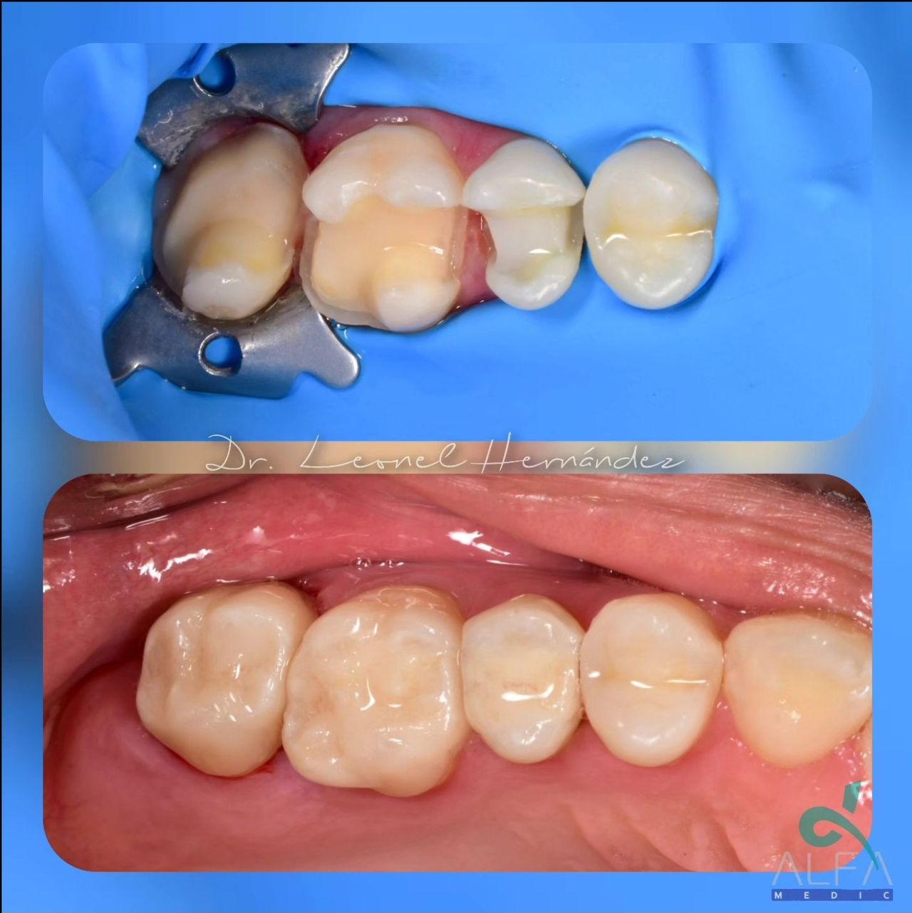 Leonel Hernández Gómez-6