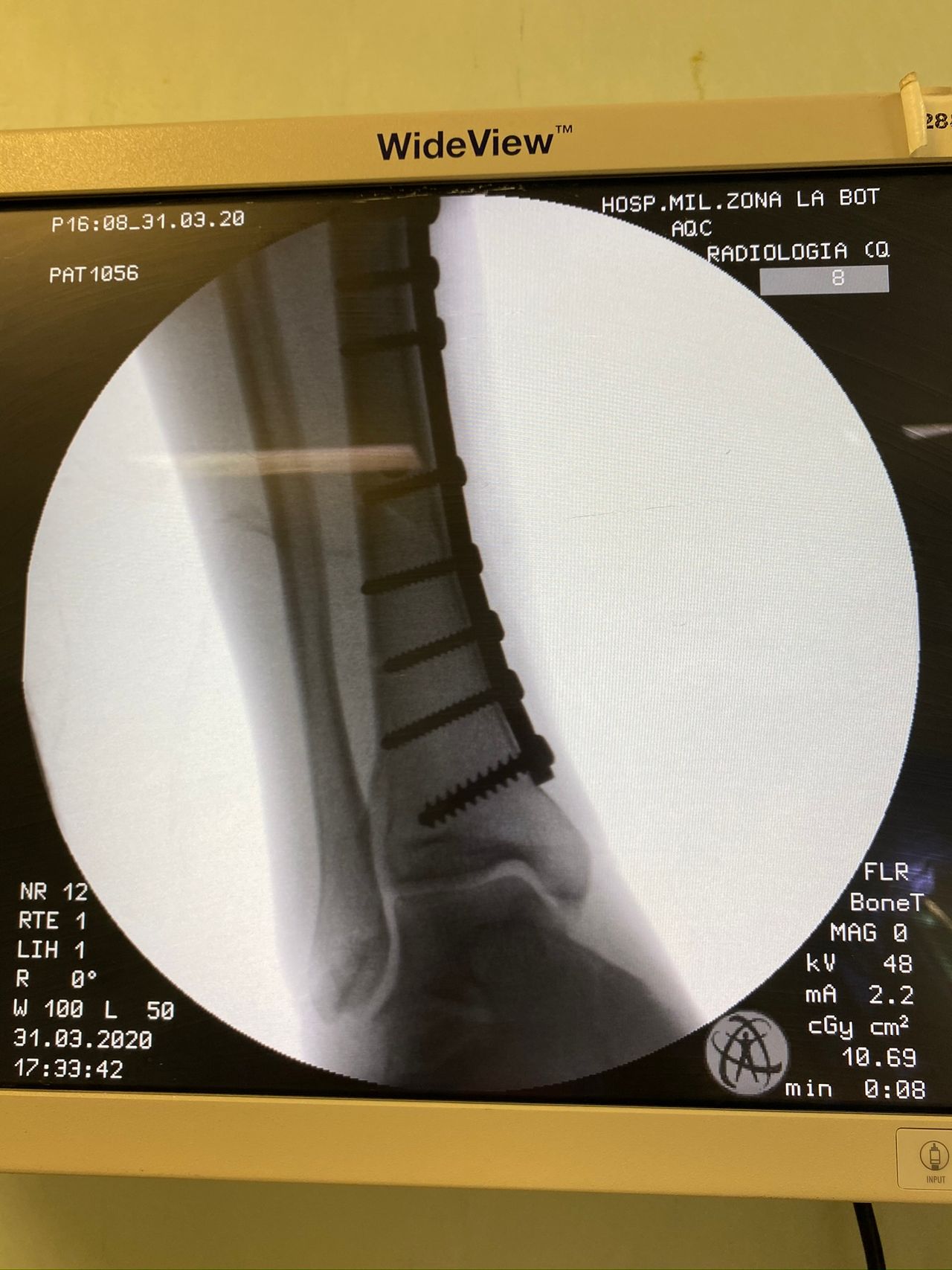 Alberto Lorenzo Cortés-13