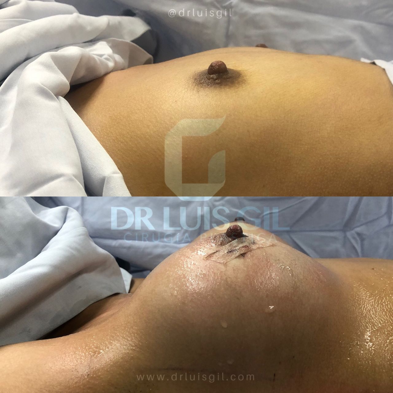 Luis Atilio Gil Pérez-23