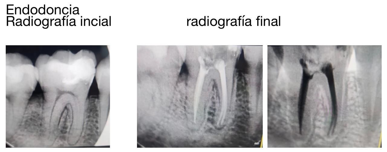 Elvia Isela  Miramon Martinez -0