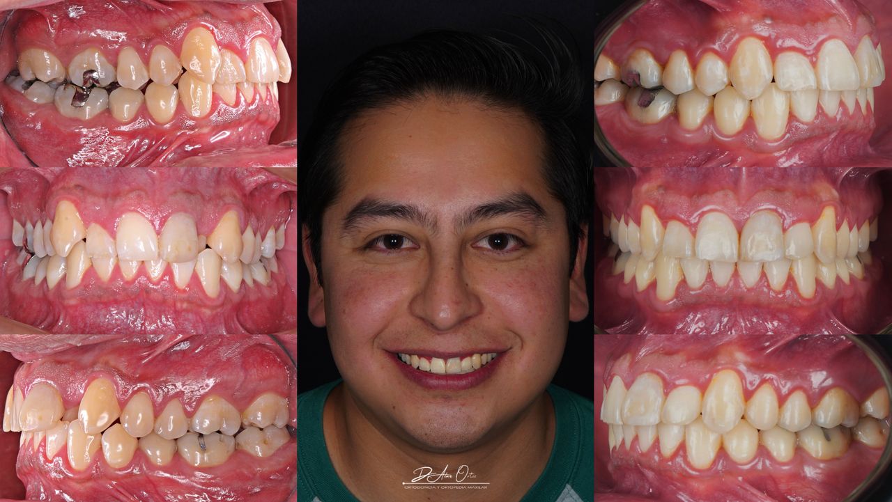 Alan Ortiz-6