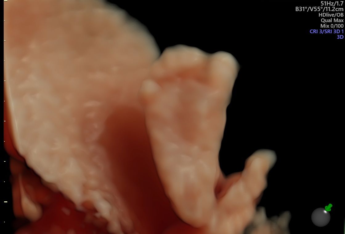 Alberto Bañuelos Peña-5