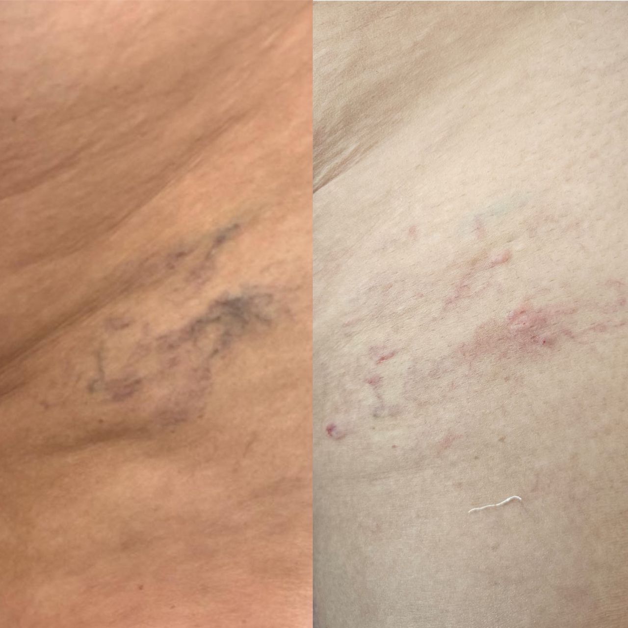 Ana Karen Ramirez Cisneros-5