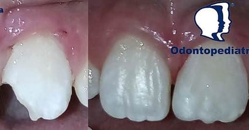 Luis Fernando Galicia Chacón-14