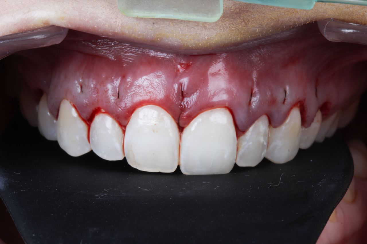 Hugo Enrique Aguilar Lamas-98