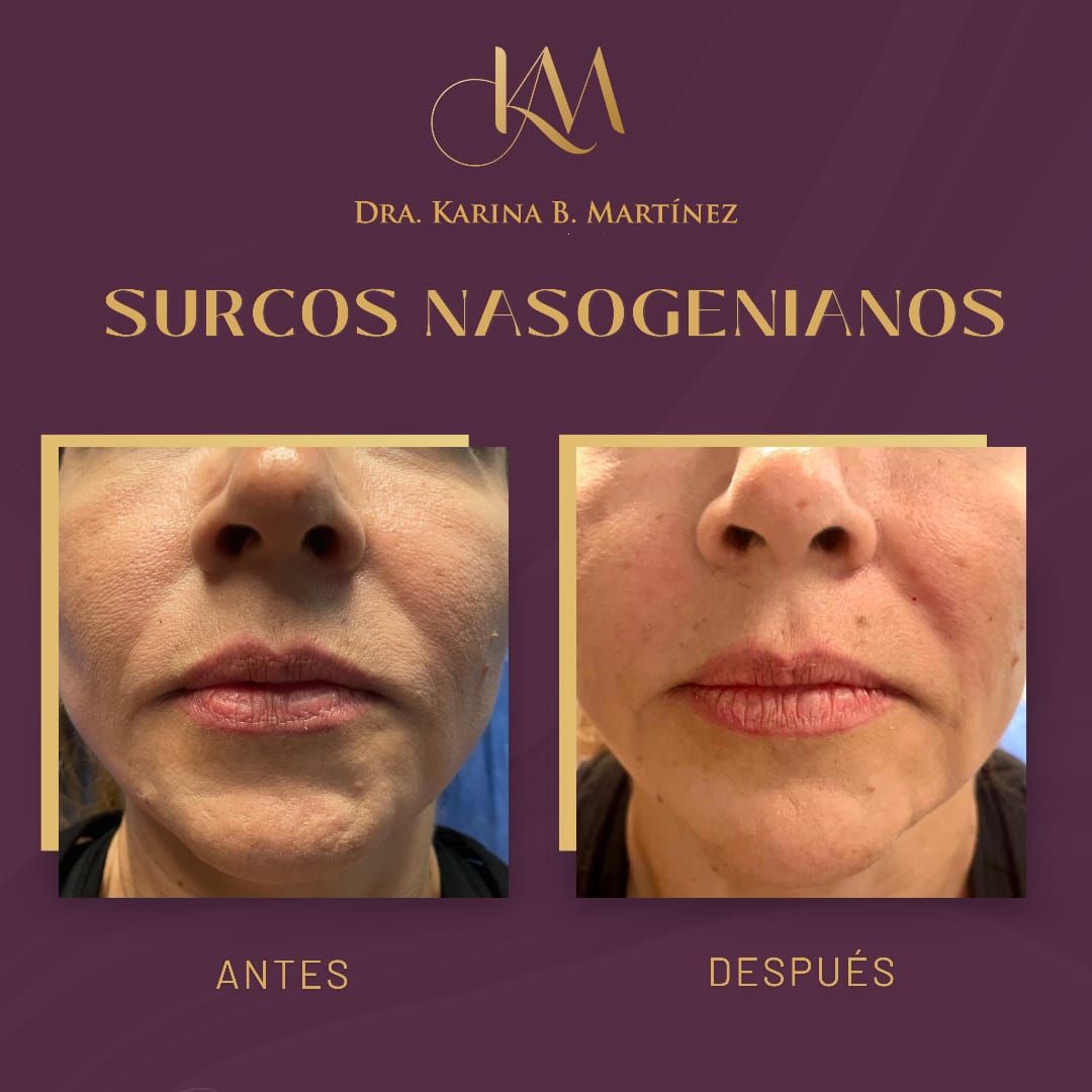 Karina Martinez Chavarria-9