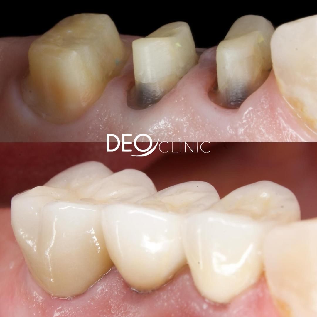 Oscar Raygoza Carrillo-43