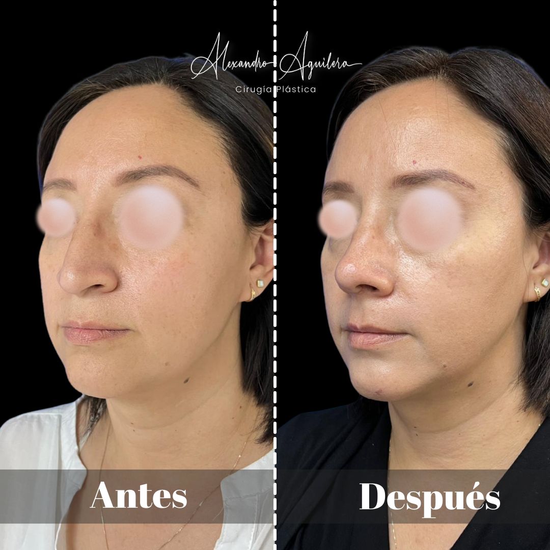 Alexandro Aguilera Salgado-48