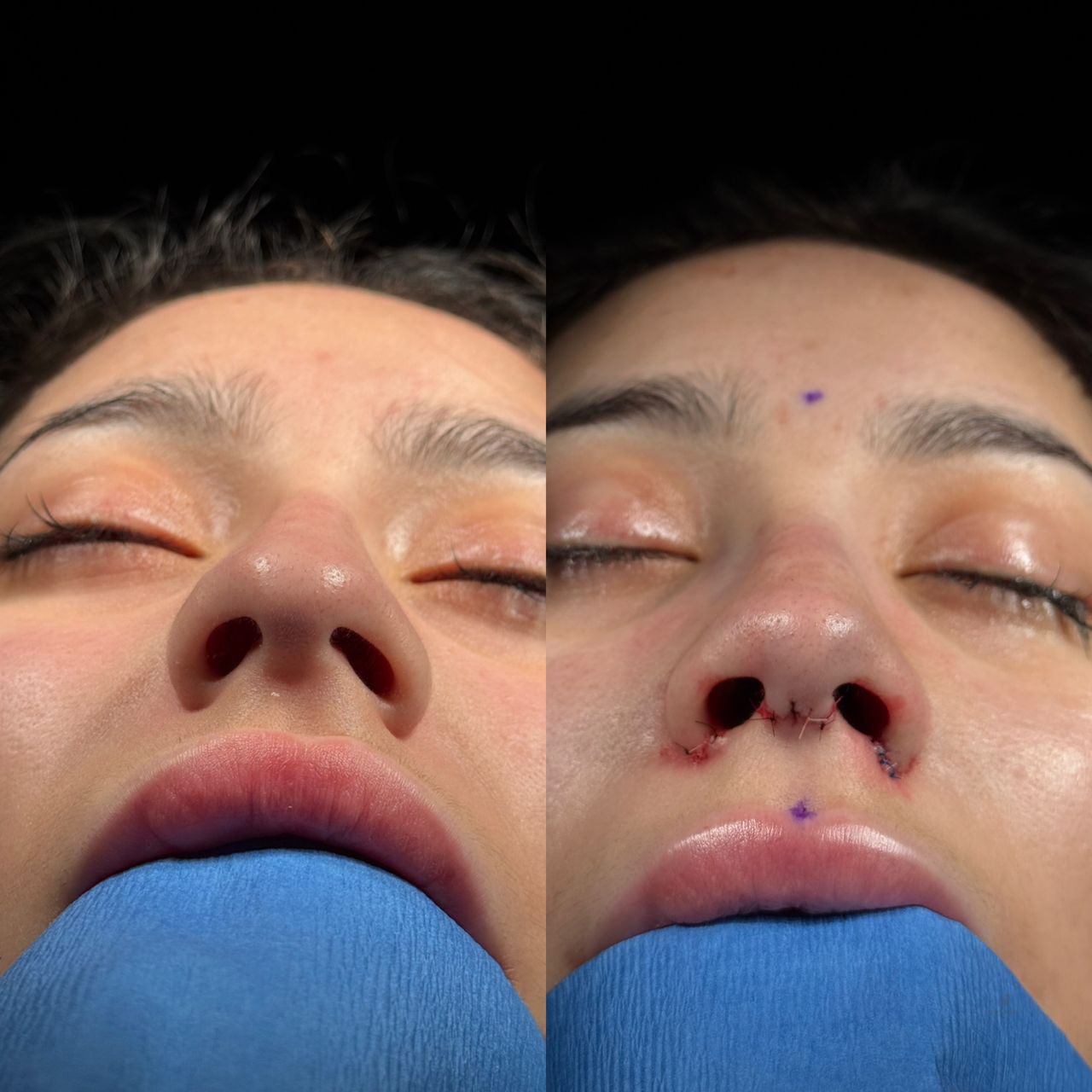 Angel Castro Urquizo-212