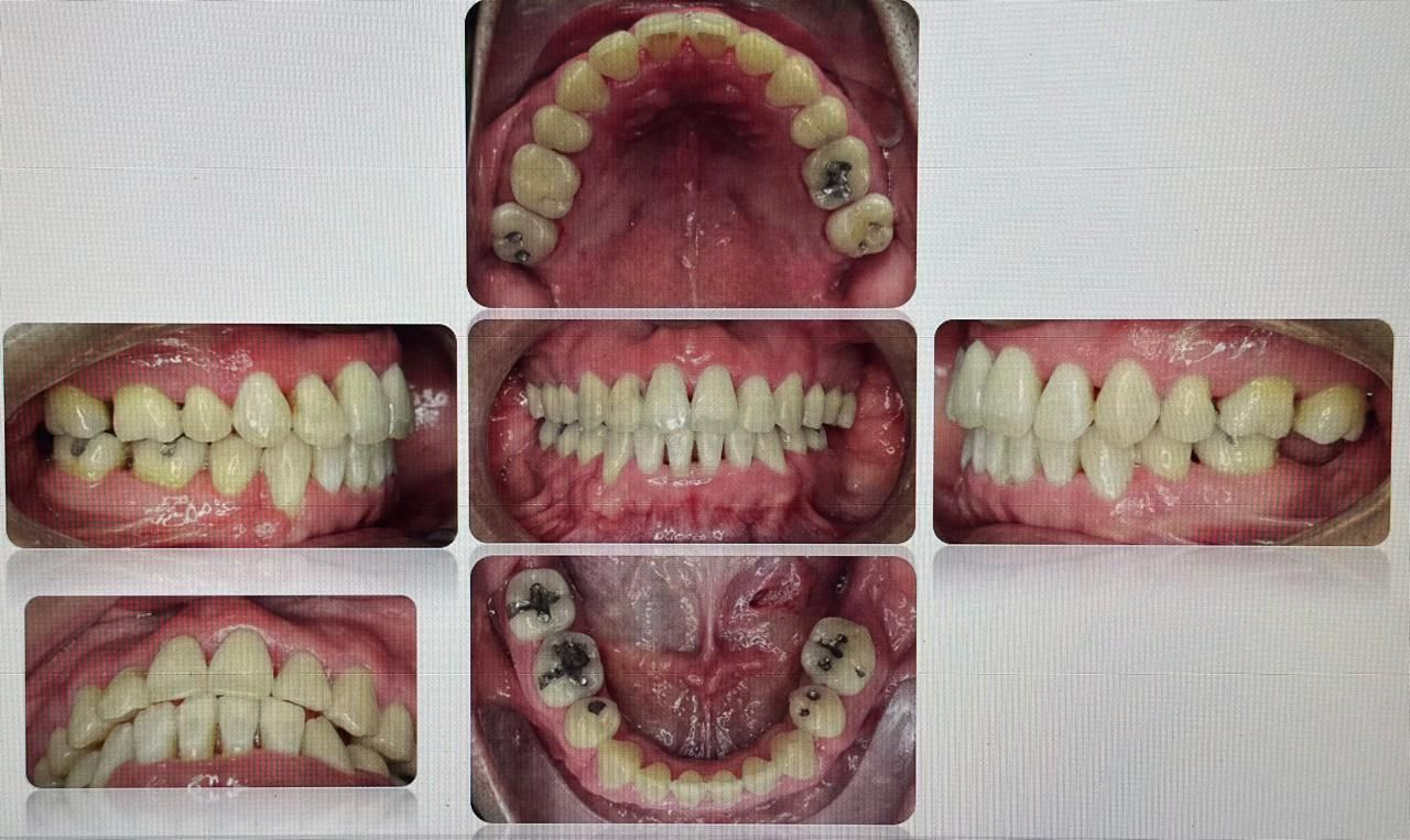 Antonio Gomez Arenas-6