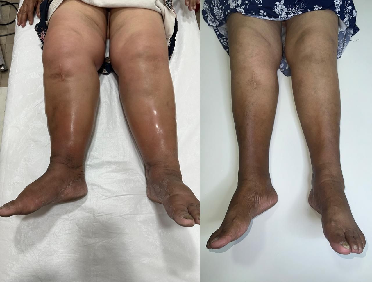 Jhonatan López González-31