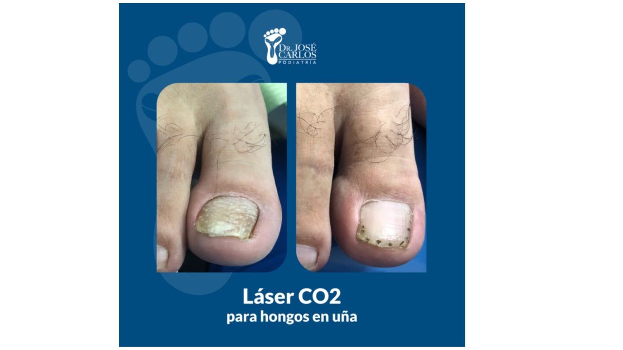 José Carlos Lopez Garza-11