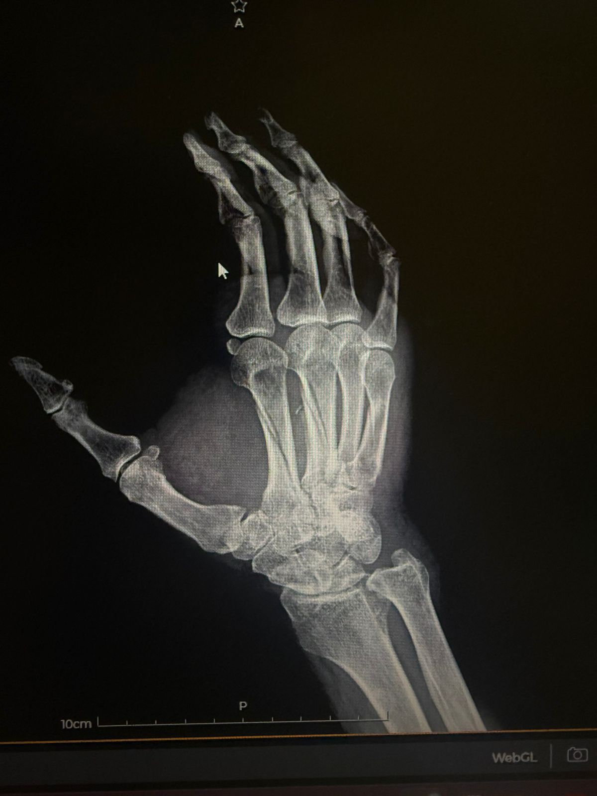 Alejandro Irisson-12