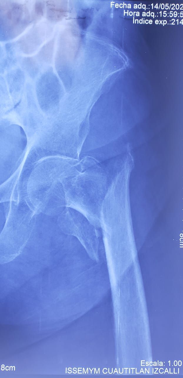 Julio Carlos Vélez De Lachica-20