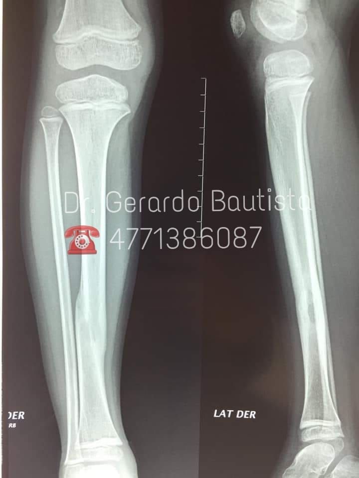 Gerardo Bautista Díaz-8