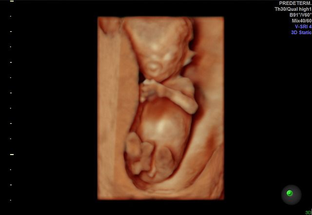 Graciela Elizabeth De La Torre Alvarez-20