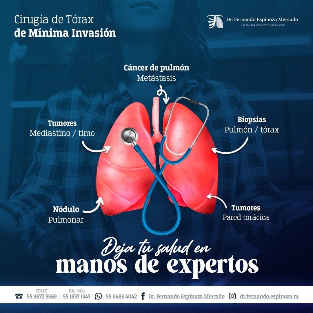 Fernando Espinoza Mercado-9