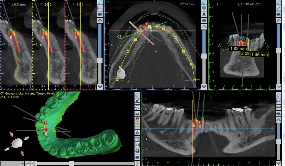 Agustin Salamanca Tapia-23