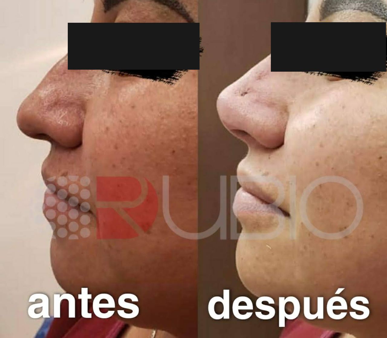 Miguel Rubio Henaine-22
