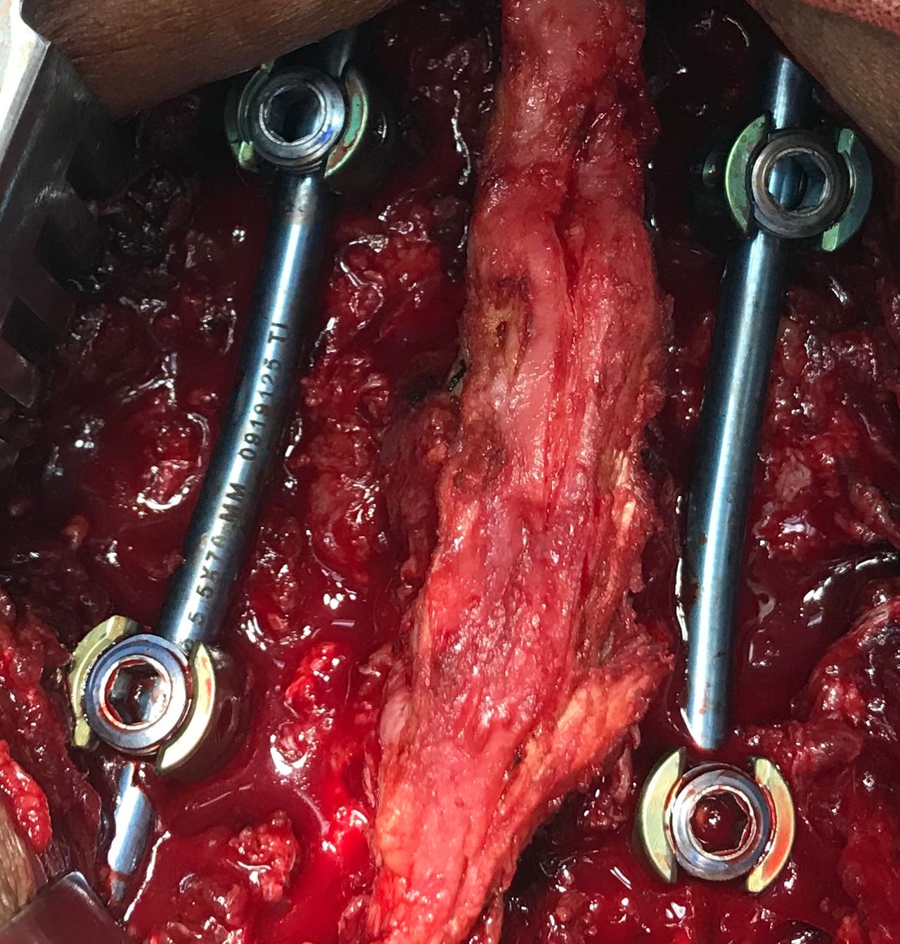 Rafael Maciel Morfin-34