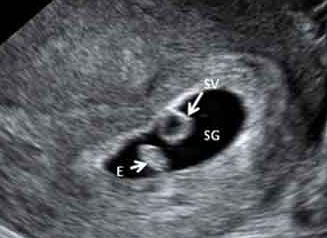 Linda Carmín Jimenez Ibáñez-9