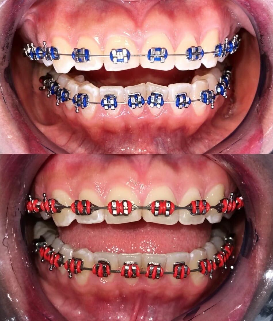 Luz Anel Valente Lozano-17