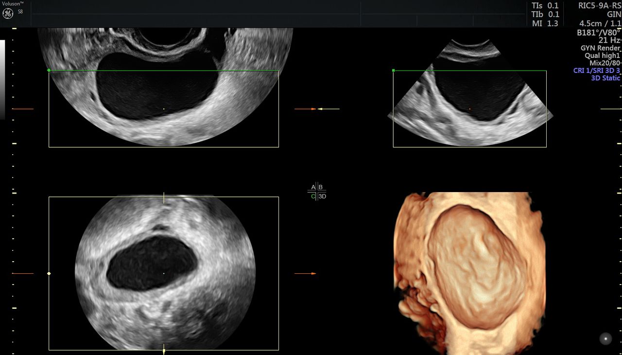 Griselda Reyes Torres-87