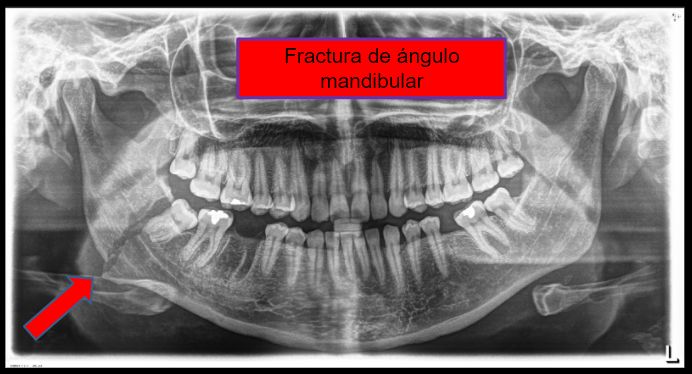 Diana Araceli Dávila Hernández-17