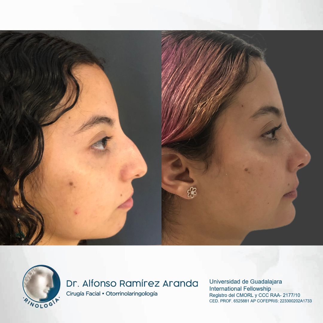 Alfonso Ramírez Aranda-10