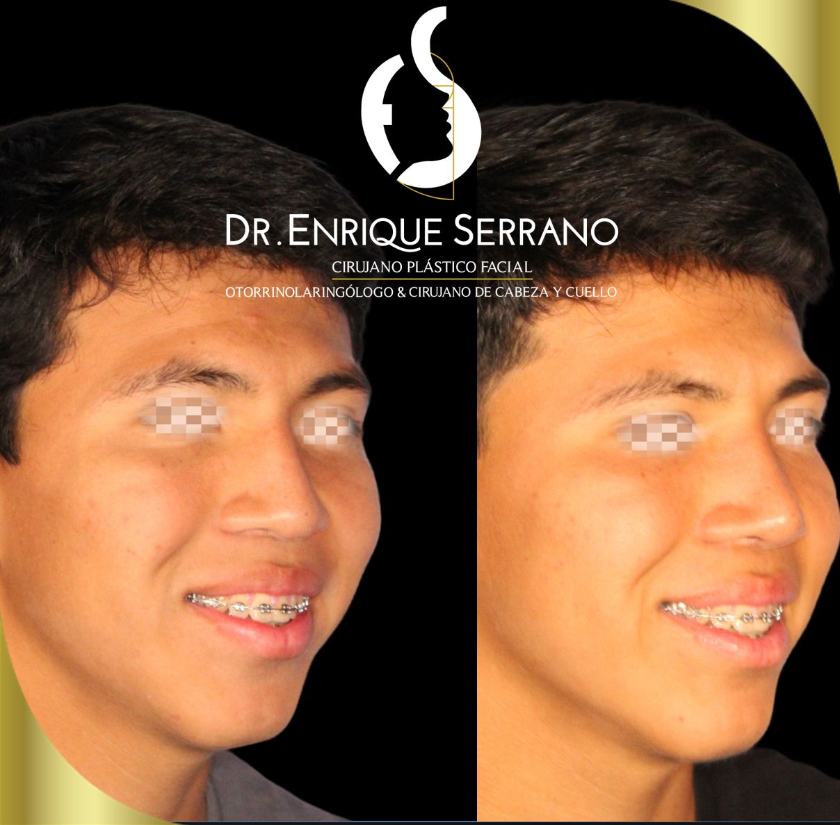 Enrique Serrano Cruz-11