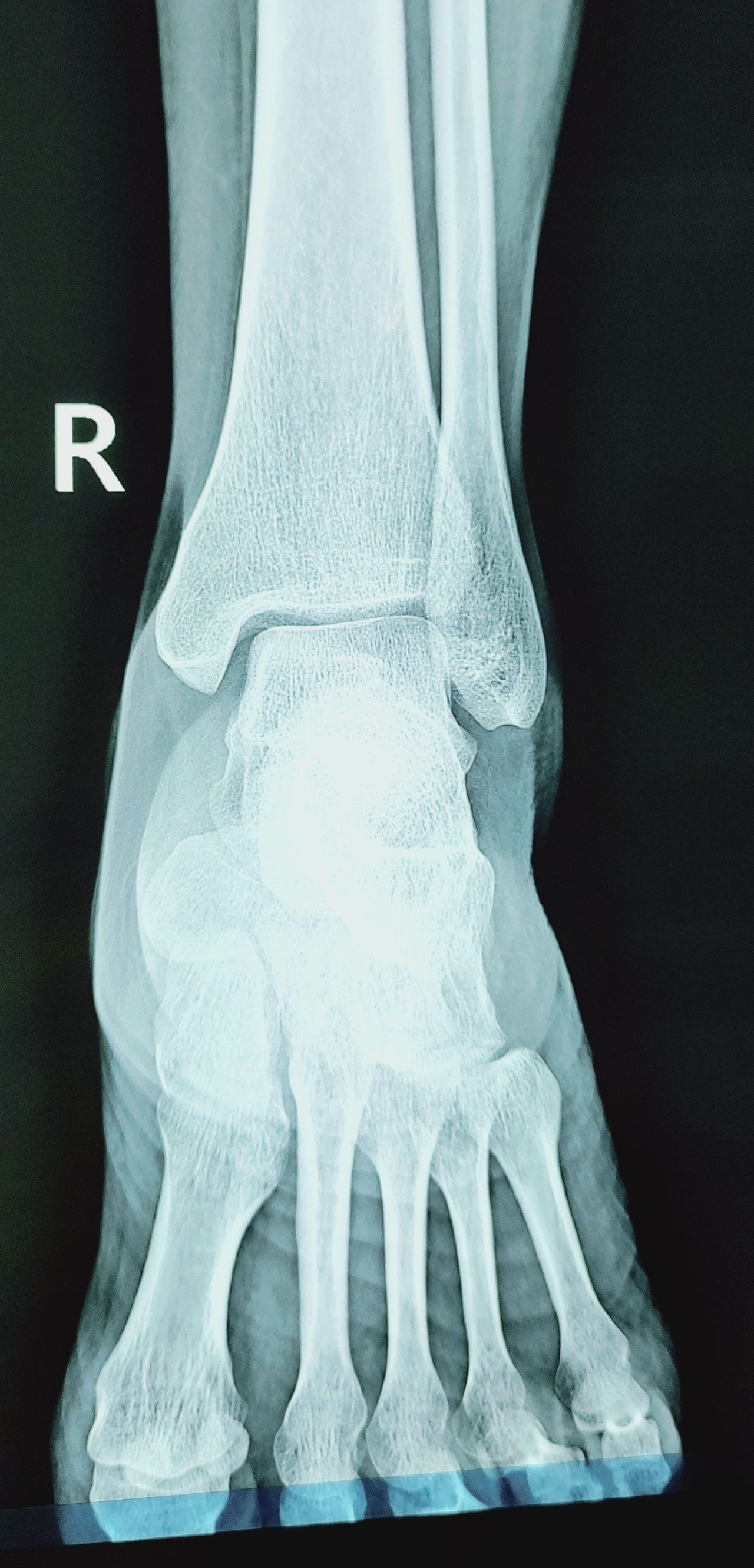 Lizeth Patricia Mena Rivas-22